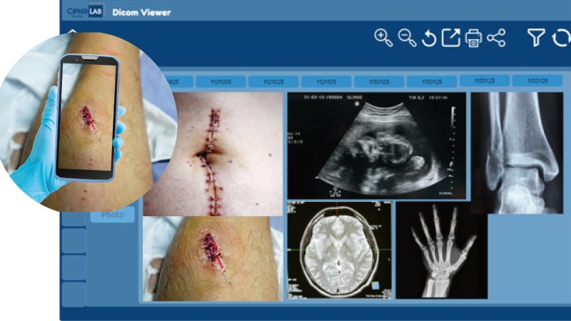 Easy Capture and Enter Wound Condition for Improved Documenting Operations